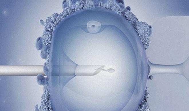 Mikroenjeksiyon Tekniği Ve Tüp Bebek Arasındaki Farklılıklar ~ Net Gazete Haber