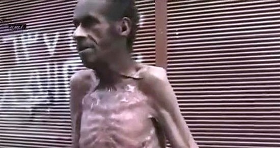 Suriye'de Dram! ''Ne Zamandır Yemek Yemediğimi Bilmiyorum''