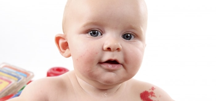 Doğum Lekeleri Endişe Yaratmalı mı?