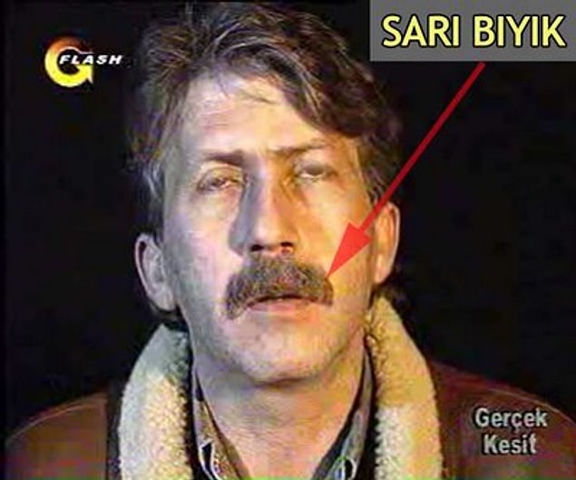 Pis sarı bıyık geldi ve böbreklerinizi çalmak istiyor. Bu durumda ne yapardınız?