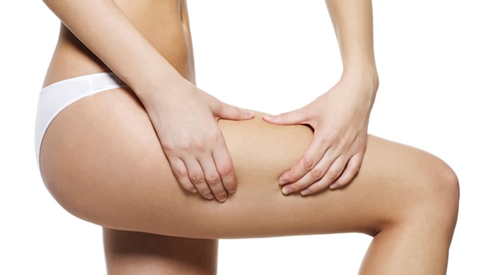 Selülitler Hakkında Yanlış Bilinenler