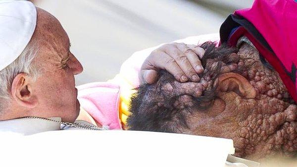 32. Papa Francis, genetik bir hastalığı olan Vinicio Riva'yı kucaklıyor. Bu olay, yeni Papa'nın yaptığı en birleştirici davranışlardan bir tanesiydi. (2013)