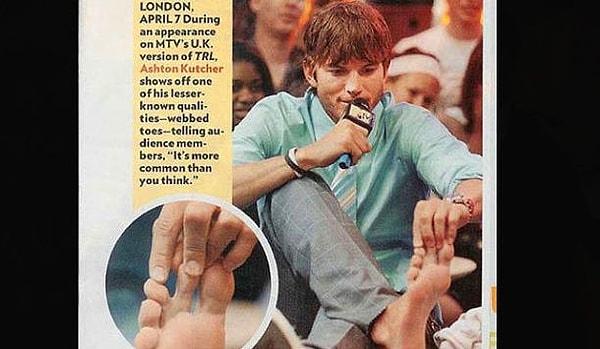 İflah olmaz çapkın Ashton Kutcher’in Bug’ı: Sağ ayak parmaklarından ikisi birleşik