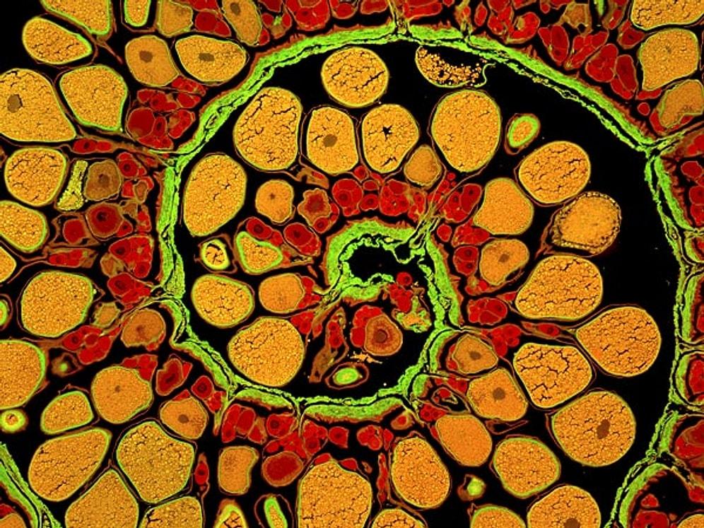 Mikroskop Altında 50.000 Kez Büyütülmüş 9 İlginç Şey
