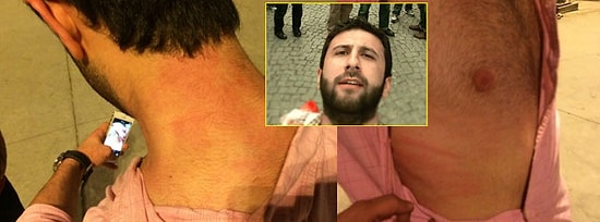 ‘Barva’ AKM Fotoğrafı Yüzünden Darp Edildi