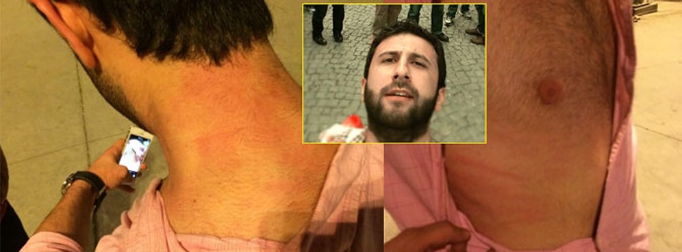 ‘Barva’ AKM Fotoğrafı Yüzünden Darp Edildi