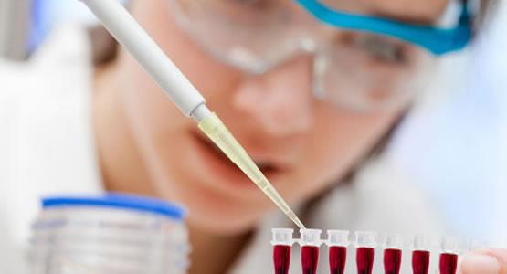 Bilim İnsanları Ölme İhtimalini Tahmin Eden Kan Testi Keşfetti 4167
