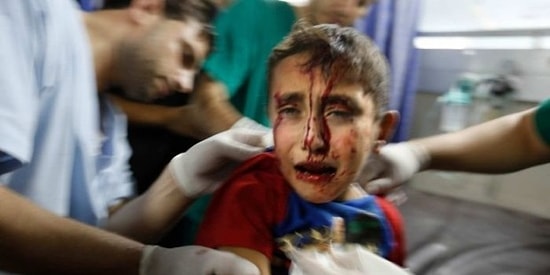 Gazze'deki Sivil Ölümlere Batı Dünyasından İlk Ciddi Tepki İngiltere'den