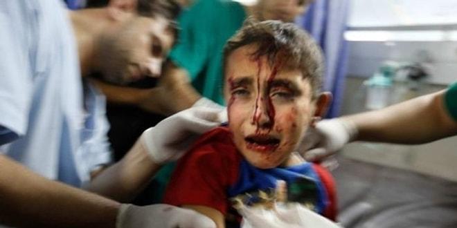 Gazze'deki Sivil Ölümlere Batı Dünyasından İlk Ciddi Tepki İngiltere'den