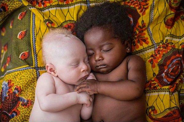 9. Kongo Kinshasa'da kuzeniyle beraber mutlu bir şekilde uyuyan 3 haftalık Albino bebek