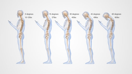 Cep Telefonları Kamburlaştırıyor mu?