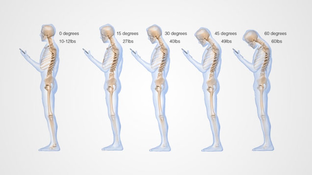 Cep Telefonları Kamburlaştırıyor mu?