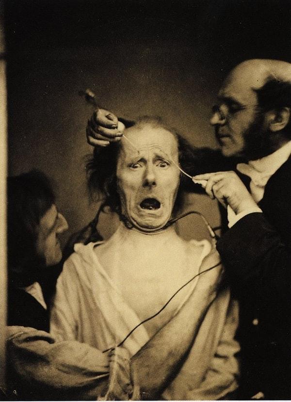 1. Nörolog Duchenne de Boulogne, yüz kaslarıyla ilgili çalışması için bir adamın yüzüne elektrik verirken.