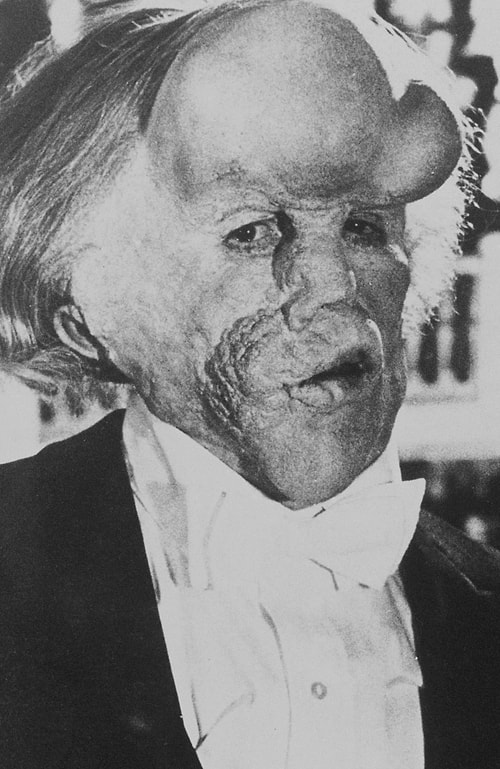 John Hurt - The Elephant Man (1980)