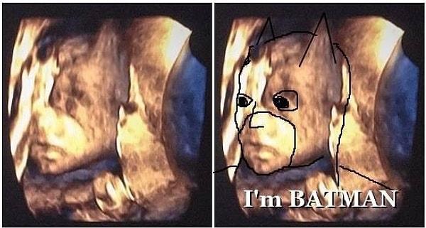 16. Bruce Wayne'in ultrason görüntüsü
