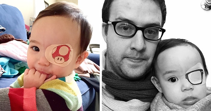 Hastalığı Nedeniyle Göz Bandı Takmak Zorunda Olan Küçük Kızını Mutlu Etmeye Çalışan Baba