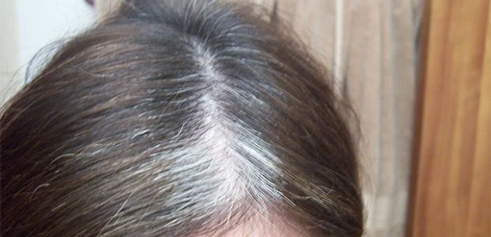 Beyaz Saçlara Doğal Çözümler