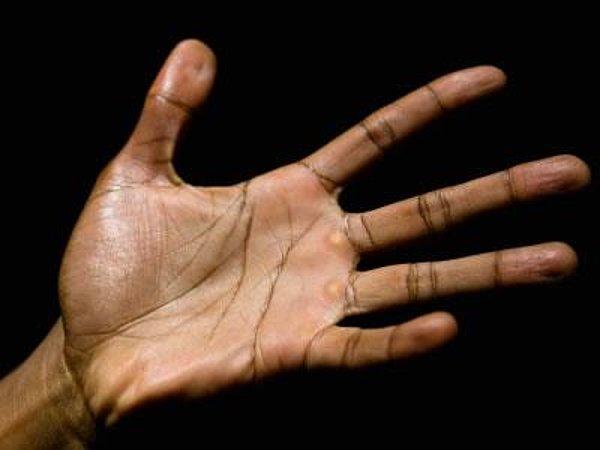 10. Gergin olduğumuzda ellerimiz neden terler?