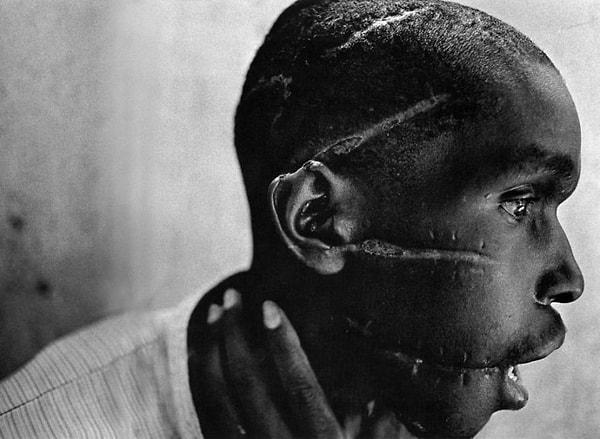 16. Ölüm kampından salındıktan sonra, yüzü kesikler içinde kalan Ruandalı bir genç.