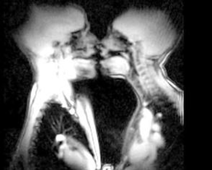 Sevgilinizle Öpüşürken Aklınızda Bulunması Gereken Süper Bilgiler