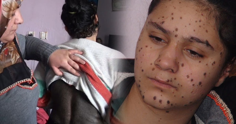 'Lütfen İmkanı Olan Bana Yardım Etsin'