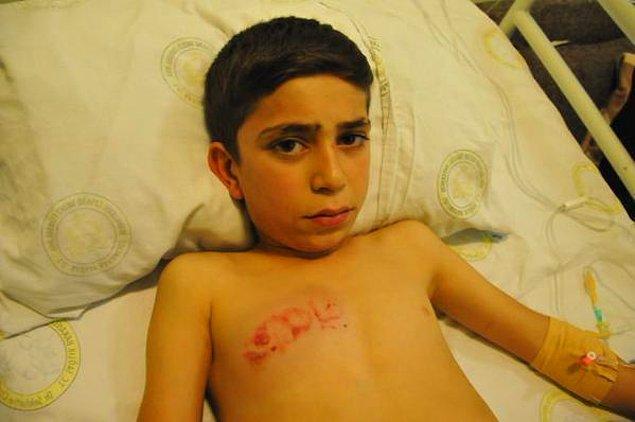 4. Cizre'de Gaz Fişeğiyle 11 Yaşında Bir Çocuk Yaralandı