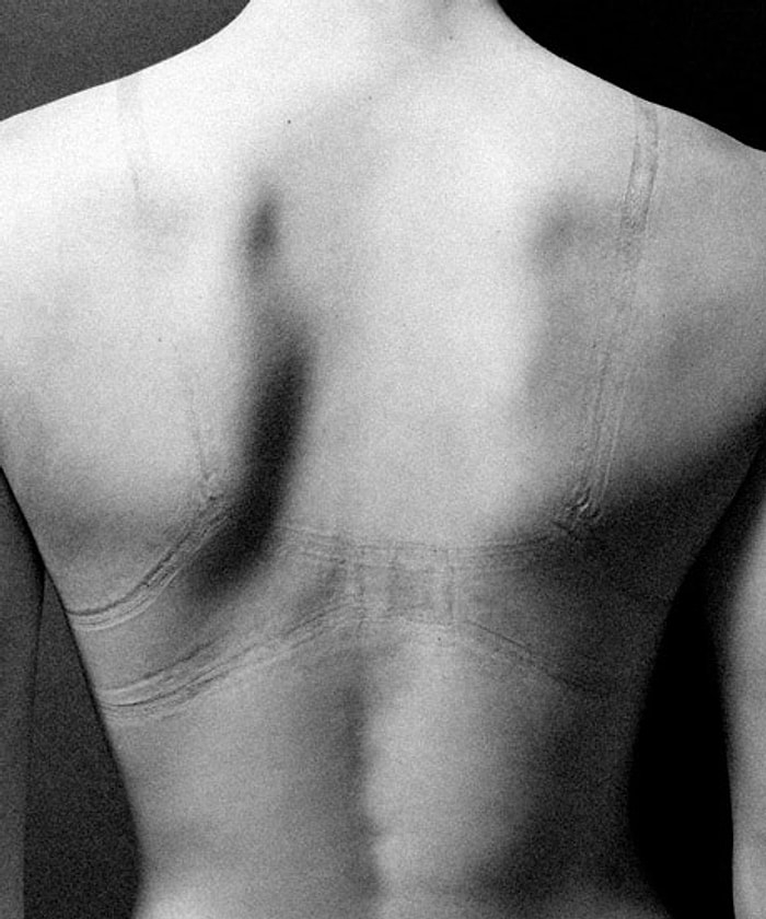 Fazla Dar Kıyafetlerin Vücuttaki Etkilerini Gösteren 10 Fotoğraf