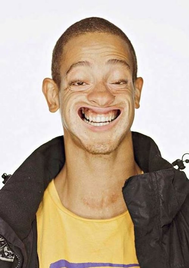 2.