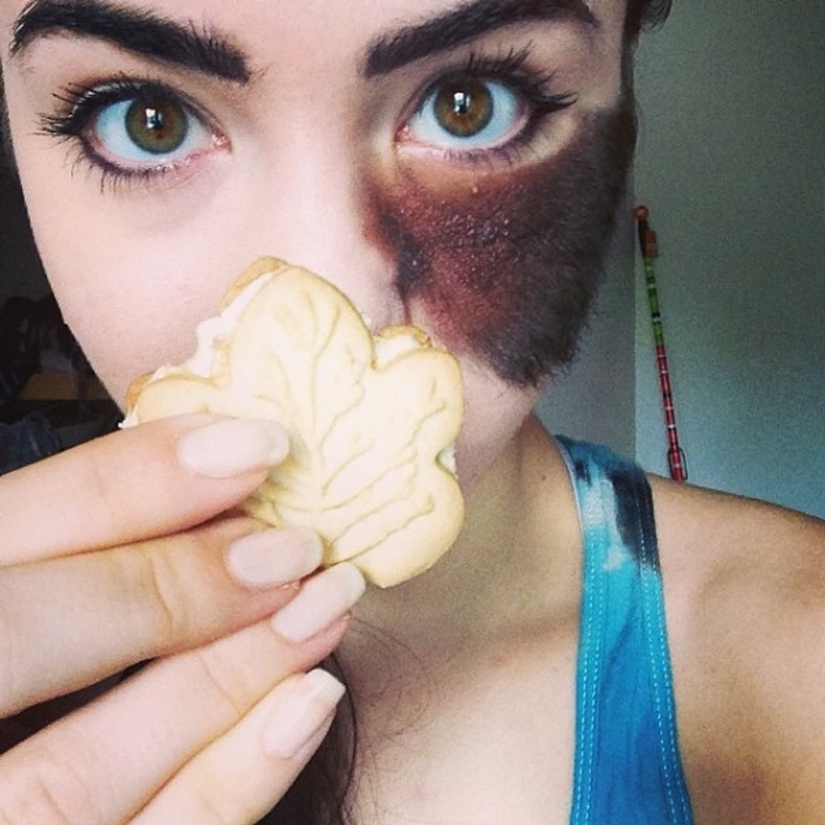 Cassandra naud hairy birthmark