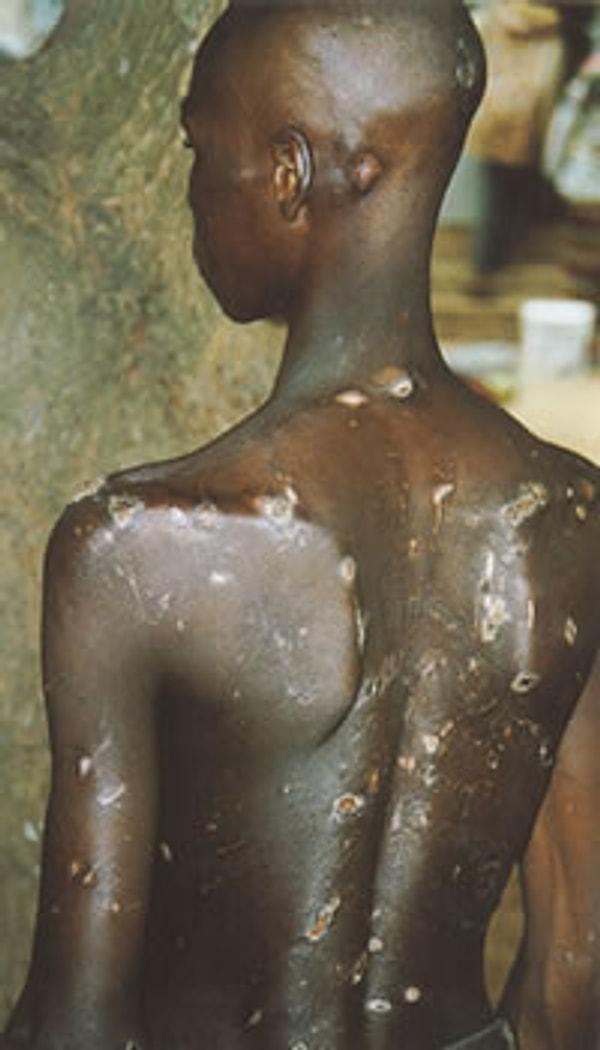 3. Köle olarak çalıştırılan çocuklar aynı zamanda dayak ve cinsel istismar başta olmak üzere çeşitli kötü muamelelerle de karşı karşıya