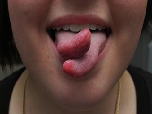 Tongue Splitting