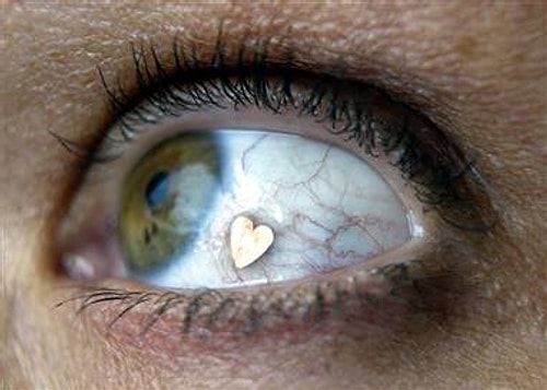 Eyeball Implant