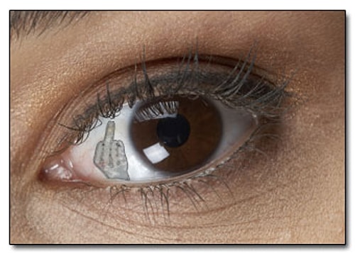 Eyeball Implant