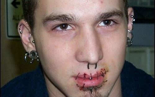 Lip Sewing