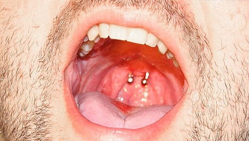 Uvula Piercing