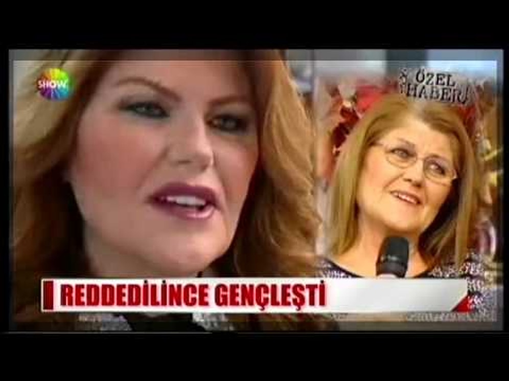 İzdivaç Programında Reddedilince Estetik Ameliyatı Olan Kadın