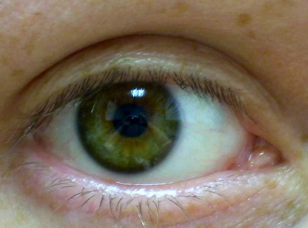 Ela, Kehribar, Bal ve Daha Fazlası! Göz Rengini Tam Olarak Söylemek ...