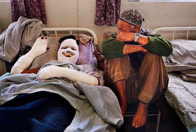 11. Yaşlı babası refakatinde vücudundan ciddi şekilde yaralanmış adam, Kabil, Afganistan