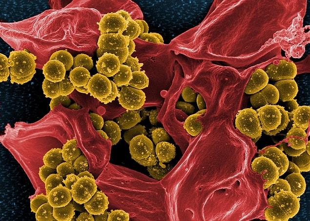 7. Süper mikroplar, her yıl 10 milyon insanı öldürebilecek.
