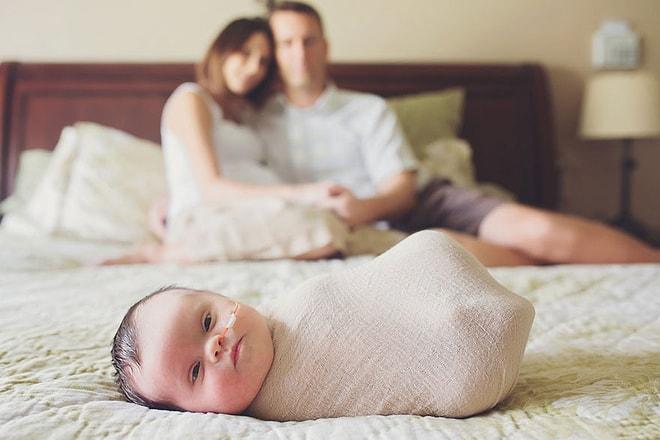 Ölümcül Bir Hastalığı Olan Bebeklerini Sevgi ile Sarmalayan Ailenin İç Burkan Fotoğrafları