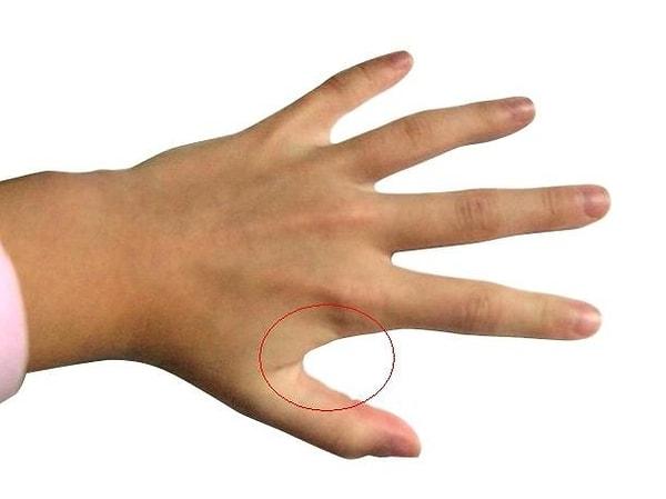 1. Diş ağrısı çekiyorsanız aha da tam şu işaretli yeri, işaret parmağı ile başparmak arasındaki bölgeyi buzla ovalayın.
