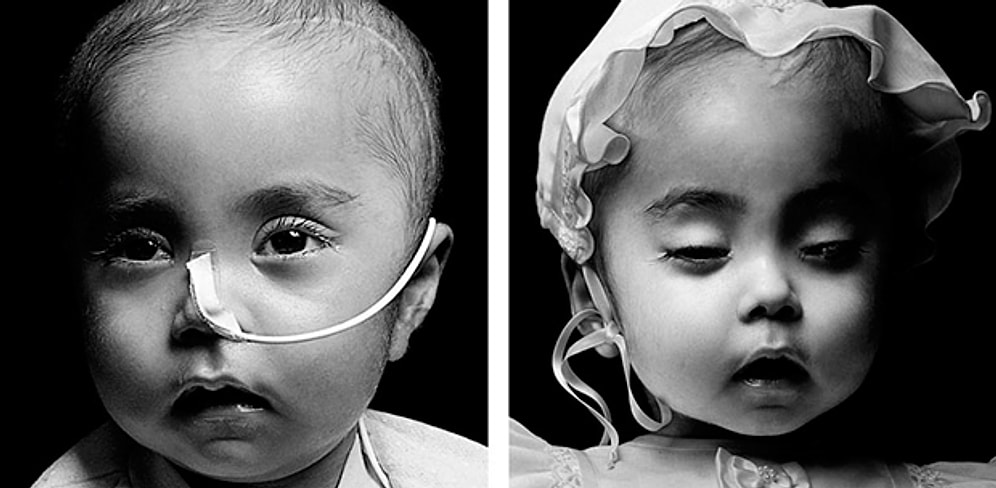 Bu Dünyayı Ardında Bırakıp Gitmiş Kişilerin Ölmeden Önce ve Sonra Çekilmiş Fotoğrafları