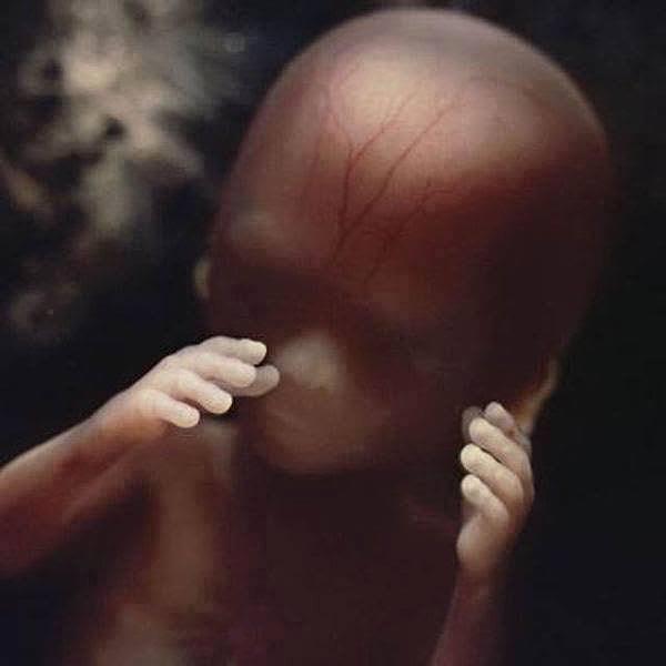 16. haftadaki fetüse başka bir açıdan bakış
