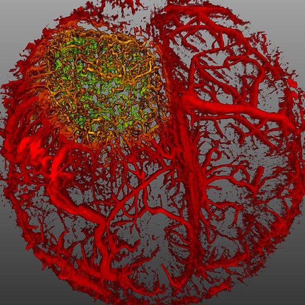 5. Beyin tümörü bulunan bir farenin beynindeki damar düzeninin görüntülenmesi - Dr. Giorgio Seano & Dr. Rakesh J. Jain.