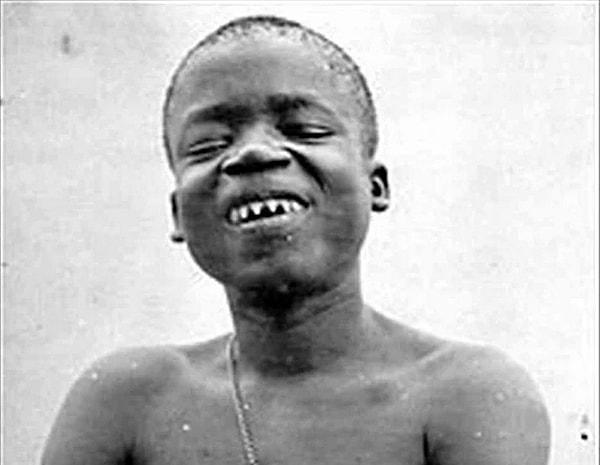 Ziyaretçiler, Afrika'nın saf yamyamlarından biri diye lanse edilen Ota Benga'nın kendisini görmek için 25 sent, ekstradan bir de dişlerini görmek için fazladan 5 sent para ödüyorlardı.