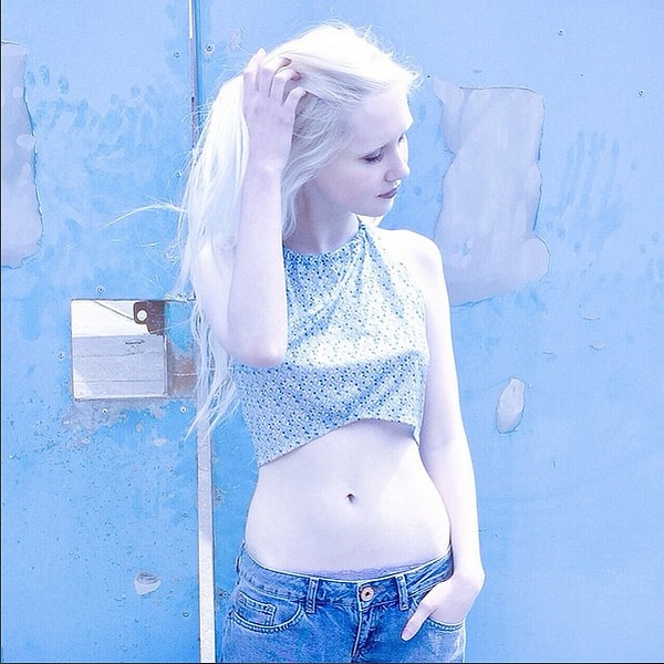 Волосы и брови Жожо красит в тон коже, поэтому все считают ее альбиносом