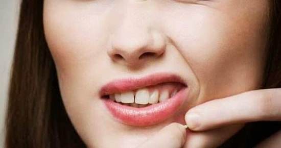 Yüzünüzde Sivilce Varsa Onu Sıkmadan Önce Duymanız Gereken Birkaç Güzel Haber Var!