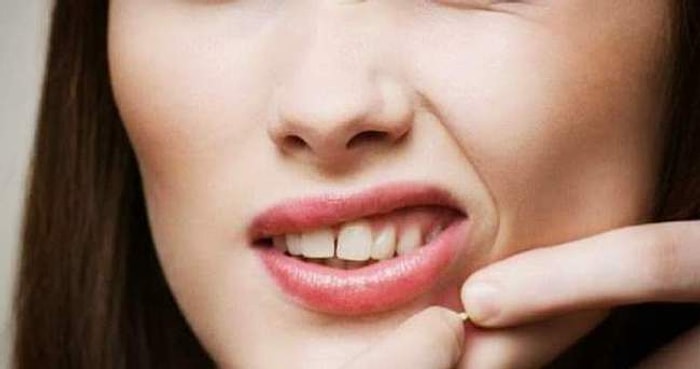 Yüzünüzde Sivilce Varsa Onu Sıkmadan Önce Duymanız Gereken Birkaç Güzel Haber Var!