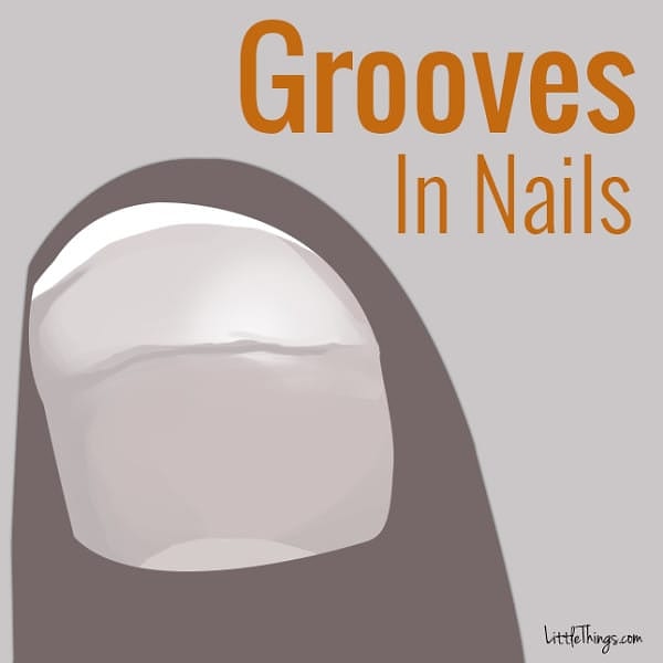 6. Желобки на ногтях