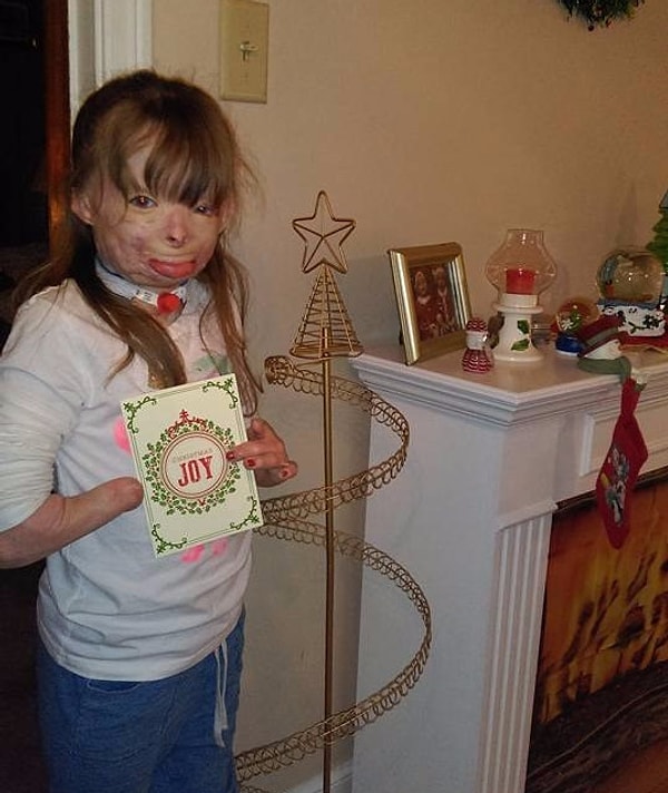 Несмотря на все трудности, выпавшие на долю этой малышки, сестра её отца - Лиз Долдер – сообщила, что Сафира ужасно обрадовалась, когда они купили елку, чтобы нарядить ее на Рождество. Однако, Лиз не была уверена, что им хватит открыток, чтобы сделать это так, как  хотелось девочке.